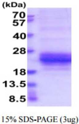 SDS-PAGE: Recombinant Human NKG2A/CD159a/KLRC1 His Protein [NBP2-59898]