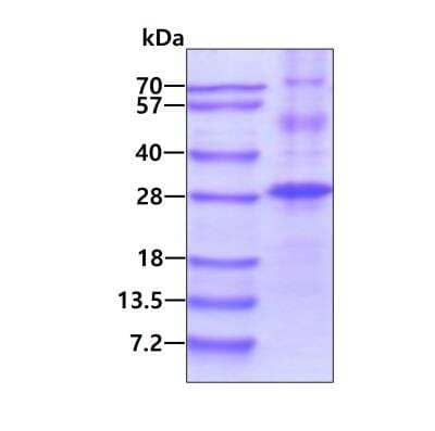 SDS-PAGE: Recombinant Human NKIRAS1 His Protein [NBP1-99105]