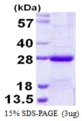 SDS-PAGE: Recombinant Human NKIRAS2 His Protein [NBP1-99008]