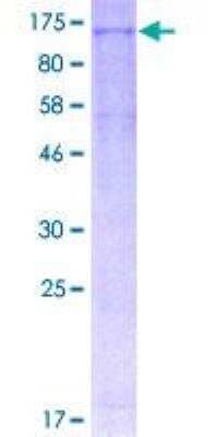 SDS-PAGE: Recombinant Human NLRP3/NALP3 GST (N-Term) Protein [H00114548-P01]