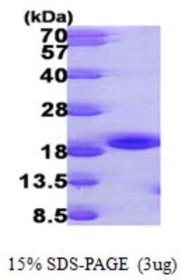 SDS-PAGE: Recombinant Human NME3 His Protein [NBP1-50969]