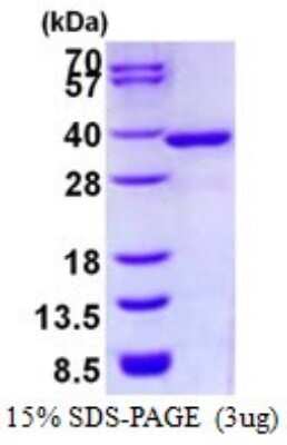 SDS-PAGE: Recombinant Human NMRAL1 His Protein [NBP1-98943]