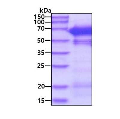 SDS-PAGE: Recombinant Human NMT1 His Protein [NBP2-51939]