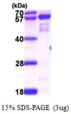 SDS-PAGE: Recombinant Human NMT2 His Protein [NBP1-50989]