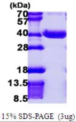 SDS-PAGE: Recombinant Human NPL His Protein [NBP1-51091]