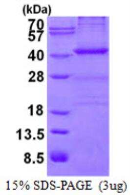 SDS-PAGE: Recombinant Human NPM1 His Protein [NBP2-75952]