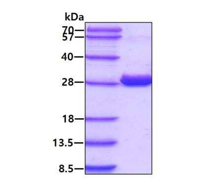 SDS-PAGE: Recombinant Human NQO-2 His Protein [NBP1-41152]