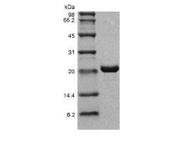 SDS-PAGE: Recombinant Human CLC Protein [NBP2-61319]