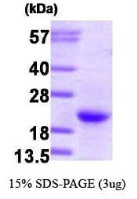 SDS-PAGE: Recombinant Human NRAS Protein [NBP1-41158]