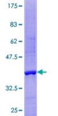 SDS-PAGE: Recombinant Human NT5C GST (N-Term) Protein [H00030833-P01]