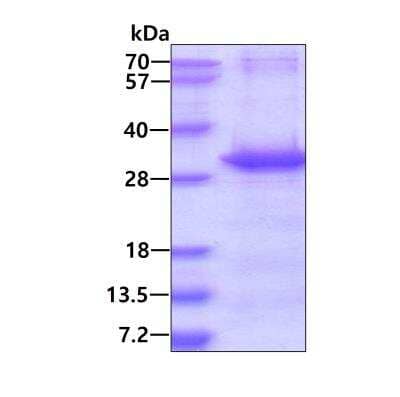 SDS-PAGE: Recombinant Human NTAL His Protein [NBP1-44385]