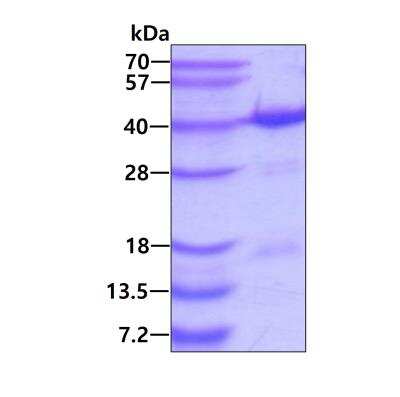 SDS-PAGE: Recombinant Human NTH1 His Protein [NBP1-72459]