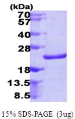 SDS-PAGE: Recombinant Human NUDT10 His Protein [NBP1-51092]