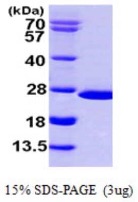 SDS-PAGE: Recombinant Human NUDT16 His Protein [NBP1-50952]