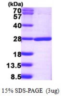 SDS-PAGE: Recombinant Human NUDT16L1 His Protein [NBP1-72283]