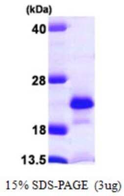 SDS-PAGE: Recombinant Human NUDT2 His Protein [NBP1-50970]