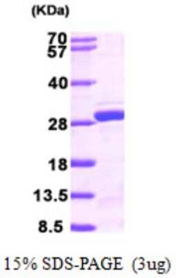 SDS-PAGE: Recombinant Human NUDT21 His Protein [NBP1-51010]