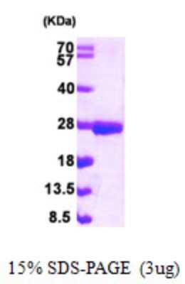 SDS-PAGE: Recombinant Human NUDT3 His Protein [NBP1-50999]