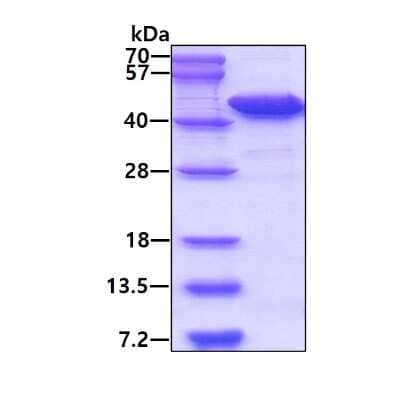 SDS-PAGE: Recombinant Human NUDT9 His Protein [NBP1-72309]