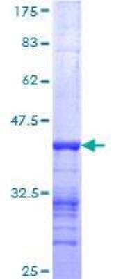 SDS-PAGE: Recombinant Human Nebulin GST (N-Term) Protein [H00004703-Q01]