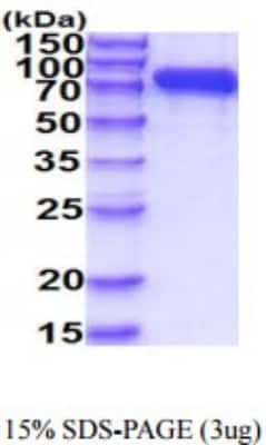 SDS-PAGE: Recombinant Human Neprilysin/CD10 His Protein [NBP2-59882]