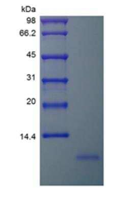 SDS-PAGE: Recombinant Human Neuritin Protein [NBP2-35073]