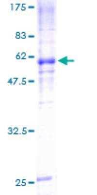 SDS-PAGE: Recombinant Human Nicotinic Acetylcholine R alpha 7/CHRNA7 Protein [H00001139-Q01]