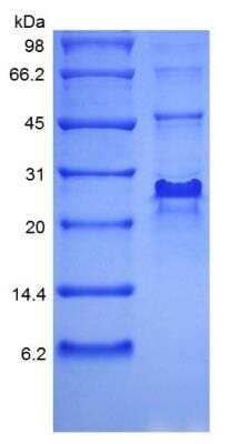 SDS-PAGE: Recombinant Human Noggin Protein [NBP2-35079]