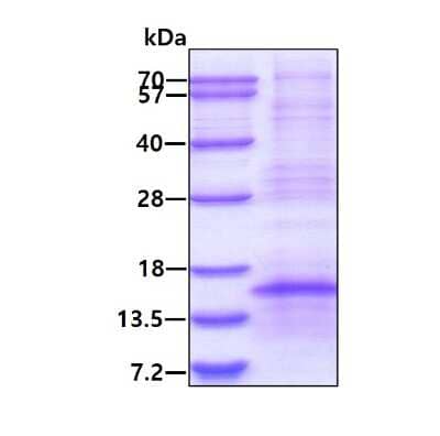 SDS-PAGE: Recombinant Human Norrin/NDP His Protein [NBP2-23294]