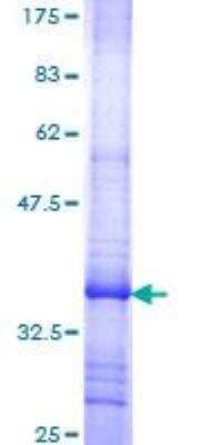 SDS-PAGE: Recombinant Human OATP1B1/OATP2 GST (N-Term) Protein [H00010599-Q01]