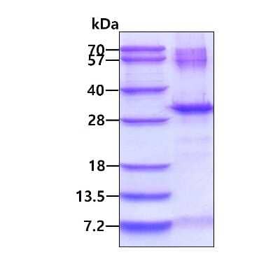 SDS-PAGE: Recombinant Human OAZ1 His Protein [NBP2-23310]