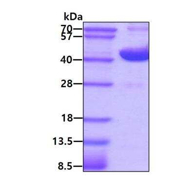 SDS-PAGE: Recombinant Human OGG1 His Protein [NBP1-45318]