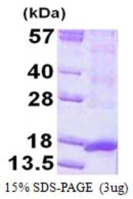 SDS-PAGE: Recombinant Human ORAOV1 His Protein [NBP1-99006]