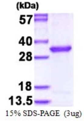 SDS-PAGE: Recombinant Human OVCA2 His Protein [NBP1-98913]