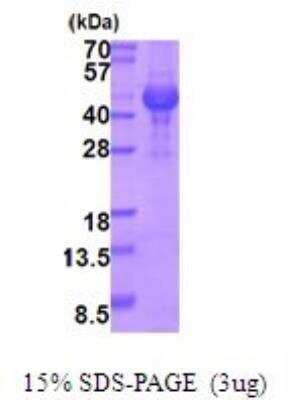 SDS-PAGE: Recombinant Human Opticin His Protein [NBP2-51922]