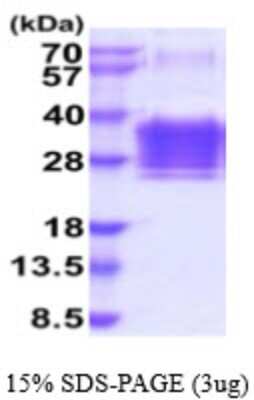 SDS-PAGE: Recombinant Human Orosomucoid 2 His Protein [NBP2-59560]