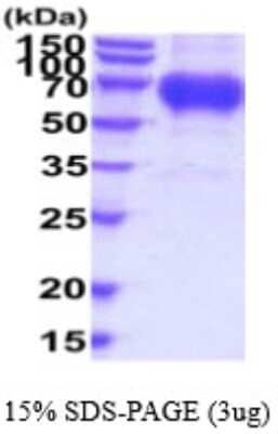 SDS-PAGE: Recombinant Human Osteoactivin/GPNMB His Protein [NBP2-59533]