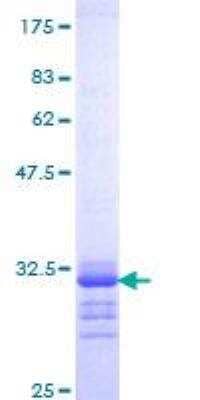 SDS-PAGE: Recombinant Human Osteocalcin GST (N-Term) Protein [H00000632-Q01]