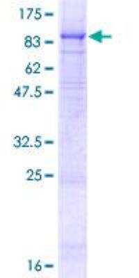 SDS-PAGE: Recombinant Human P2X7/P2RX7 GST (N-Term) Protein [H00005027-P01]