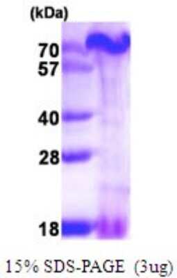 SDS-PAGE: Recombinant Human PA1 His Protein [NBP1-72305]