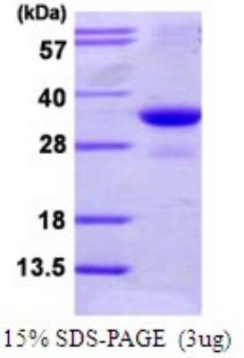 SDS-PAGE: Recombinant Human PAC2 His Protein [NBP1-72453]