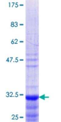 SDS-PAGE: Recombinant Human PACAP/ADCYAP1 GST (N-Term) Protein [H00000116-Q01]