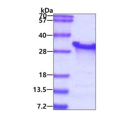 SDS-PAGE: Recombinant Human PAIP2 His Protein [NBP1-30279]