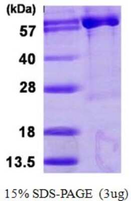 SDS-PAGE: Recombinant Human PAPSS1 His Protein [NBP1-78889]