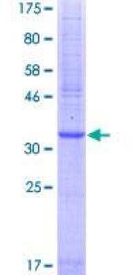 SDS-PAGE: Recombinant Human PAR2 GST (N-Term) Protein [H00002150-Q01]