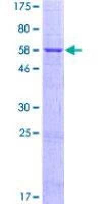 SDS-PAGE: Recombinant Human PARP16 GST (N-Term) Protein [H00054956-P01]