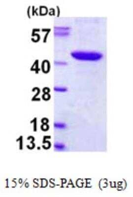 SDS-PAGE: Recombinant Human PBK His Protein [NBP1-99082]