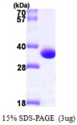 SDS-PAGE: Recombinant Human PBLD His Protein [NBP1-50876]