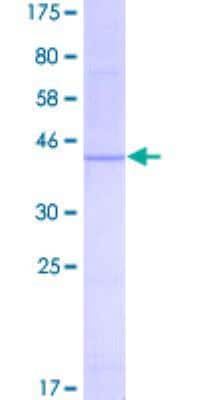 SDS-PAGE: Recombinant Human PBR GST (N-Term) Protein [H00000706-P01]