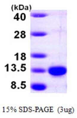 SDS-PAGE: Recombinant Human PCBD1 His Protein [NBP1-48354]